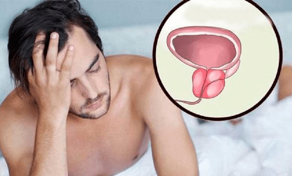 Symptome einer Prostatitis