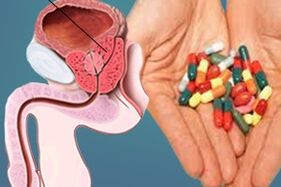Medikamente zur Behandlung von Prostatitis
